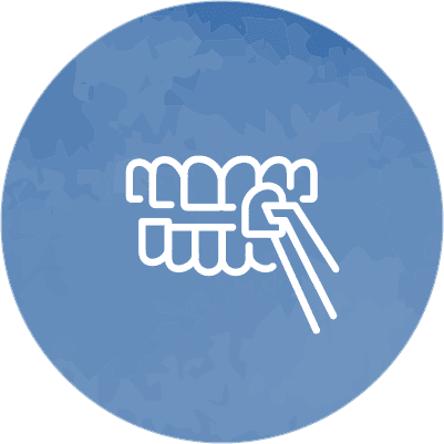 メタルフリー歯科